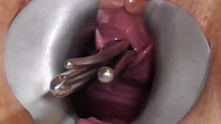 ���ጥል FreyjaAnalslut: rods ውስጥ Freyja ግምገማ pisshole